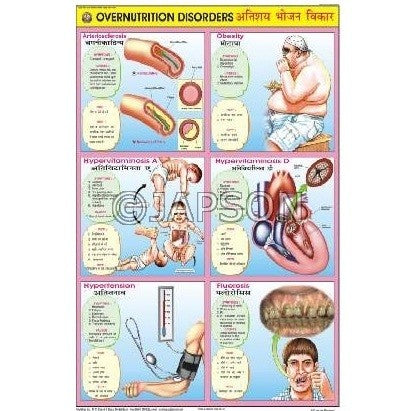 Food & Nutrition Charts, School Education Food & Nutrition Charts, School Education